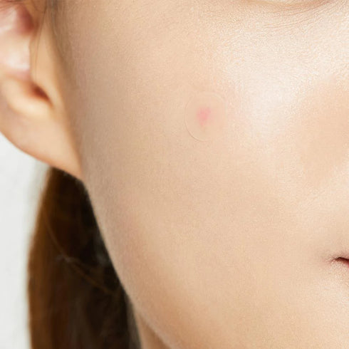 Acne Pimple Master Patch 24patches-Matakana Pharmacy